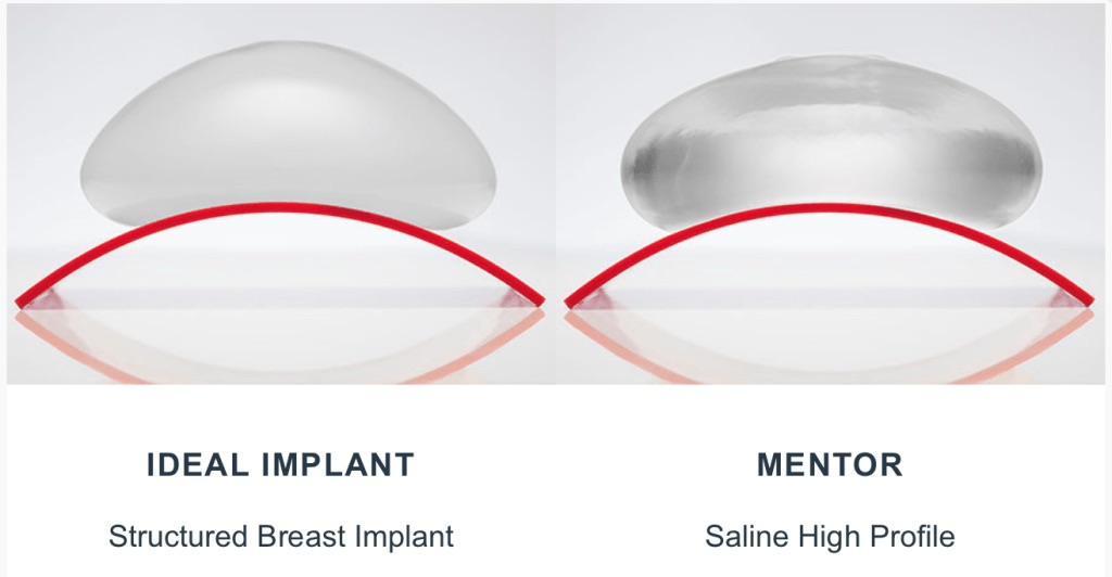 saline vs ideal implant